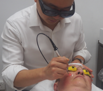 Laser Treatment for Skin Pigmentation by Aesthetic Doctor, Heng Wee Soon, The Ogee Clinic